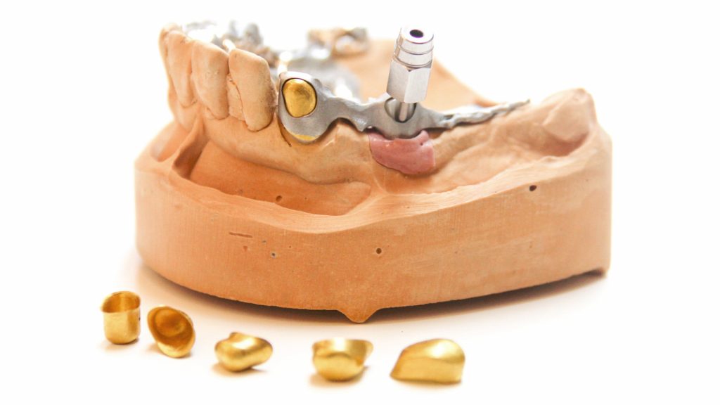 Bildbearbeitung einer Nemprotetik von dental art dresden